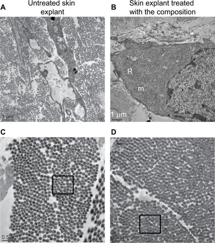 Figure 6 Observations by transmission electron microscopy of a 41 year old skin explant treated with or without the composition.Notes: (A) Telocytes with abnormal morphology and low metabolism in untreated skin conditions. (B) Telocytes with a high metabolic activity confirmed by the presence of numerous mitochondria and granulous endoplasmic reticulum. (C) In the untreated skin explant, the diameter of collagen fibrils appears heterogenous, (D) whereas in treated skin explant the diameter of collagen fibril is homogenous (as shown before the specific black boxes in C and D).