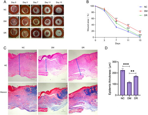 Figure 7. RSV promotes diabetic wound healing. (A) Pictures of rats with dorsal wounds. (B) Folding line graph of wound healing rate. (C) Histopathological pictures of wounds. The first row is H&E staining, and the second row is Masson staining (bar = 200 µm). (D) Epidermis thickness. NC: control group; DM: diabetes group; DR: diabetes + RSV group. ***p < .001 vs. NC. ##p < .01 vs. DM. ###p < .001 vs. DM.