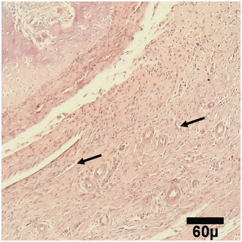 Figure 1. Microscopic section from the healing site of sham group on day 15 of healing shows abundant capillary buds (arrows) in granulation tissue (H&E, ×100).