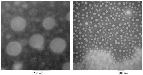 Figure 3. Transmission electron micrograph of samples without perfluorobutane.