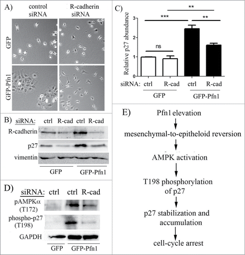 Figure 6. Epithelial reversion plays a role in Pfn1-induced p27 upregulation in MDA-231 cells. Phase contrast micrographs of GFP and GFP-Pfn1 expressors following transfection with either control or R-cadherin-specific siRNAs demonstrate that Pfn1 overexpression can induce epithelioid morphological reversion (as revealed by clustering of cells) in mesenchymal MDA-231 cells which can be reversed by silencing of R-cadherin. (B, C) Representative immunoblots (B) of total extracts from GFP- and GFP-Pfn1 expressors transfected with the indicated siRNAs (ctrl: control, R-cad: R-cadherin) showing changes in p27 expression specifically in Pfn1 overexpressors upon R-cadherin depletion (vimentin blot: loading control). The bar graph on the right (C) summarizes the data from 5 independent experiments (***: p<0.001, **: p<0.01, ns: not significant). (D) Representative immunoblots of total lysates of GFP and GFP-Pfn1 overexpressors transfected with either control or R-cadherin siRNAs show downregulation of AMPKα- and p27-phosphorylations on T172 and T198 residues, respectively, upon R-cadherin depletion (GAPDH blot: loading control). (E) A proposed model depicting that Pfn1 overexpression elevates p27 accumulation in mesenchymal breast cancer cells through impacting AMPK pathway as a consequence of cadherin-dependent epithelioid reversion.