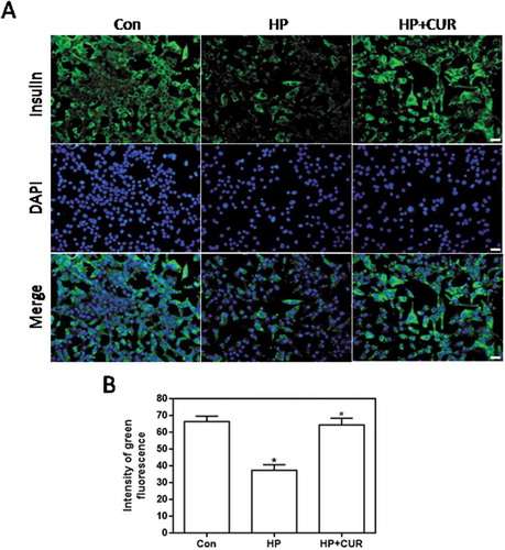 Figure 3. Effect of curcumin (20 μM) on the decreased insulin levels in INS-1 cells treated with HP. Insulin levels were assessed immunofluorescence. Insulin was stained using a FITC-conjugated secondary antibody (green), and nuclei were stained with DAPI (blue). (A) Representative images of cells stained with insulin. Scale bar: 20 μm. (B) Fluorescence intensity of insulin (*p < .05 vs Con group, #p < .05 vs HP group). n = 5 independent experiments. CUR, curcumin; HP, 30 mM glucose+0.5 mM palmitate; DAPI: 4’,6-diamidino-2-phenylindole; Con, control.