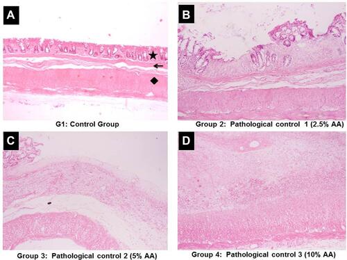 Figure 3 Representative photomicrographs of histopathological changes in the rectal tissues induced with different concentrations of acetic acid in ulcerative proctitis model.