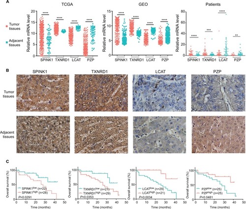 Figure 7 The expression of SPINK1, TXNRD1, LCAT, and PZP in gene and protein levels.Notes: (A) Relative mRNA levels of SPINK1, TXNRD1, LCAT, and PZP expression in TCGA, GSE14520 dataset, and human liver tumor tissues and adjacent normal tissues in patients (n=50). (B) Immunohistochemistry staining of HCC specimens with antibodies specific for SPINK1, TXNRD1, LCAT, or PZP. Original magnification, ×200. (C) Kaplan–Meier analysis of overall survival was stratified by expression levels of SPINK1, TXNRD1, LCAT, and PZP protein expression. **P<0.01, ***P<0.001, ****P<0.0001.Abbreviations: GEO, Gene Expression Omnibus; HCC, hepatocellular carcinoma; TCGA, The Cancer Genome Atlas project.