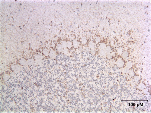 Figure 10.  Immunoperoxidase-stained cerebellum of a ruby macaw (Case 1674) showing a thick band of cells containing ABV N-protein associated with the Purkinje cell layer. The Purkinje cells remain unstained. There are also scattered antigen-positive cells throughout the granular layer. Arrows point to stained cells.