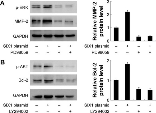 Figure 5 SIX1 regulates matrix metalloproteinase-2 (MMP-2) and Bcl-2 through extracellular signal-regulated kinase (ERK) and AKT signaling.