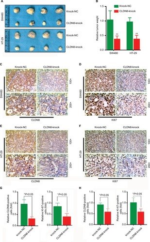 Figure 4 Knockdown of CLDN8 expression inhibits CRC growth in nude mice.Notes: (A, B) CLDN8 knockdown markedly reduced tumor weight in vivo. (C, E) IHC staining confirmed the knockdown expression of CLDN8 in SW480 and HT-29–induced tumor. (D, F) IHC staining showed that tumors formed by CLDN8-knockdown cells exhibited lower positive percentage of Ki-67 than control tumors. (G) Quantitative analysis of IHC staining in SW480-induced tumor. (H) Quantitative analysis of IHC staining in HT-29–induced tumor. The meaning of each group name: Knock-NC, the negative control group of TROP2 knockdown; CLDN8-knock, knockdown of CLDN8. *P<0.05 when compared with Knock-NC; **P<0.01 when compared with Knock-NC.Abbreviations: CRC, colorectal cancer; IHC, immunohistochemistry; WB, Western blot.