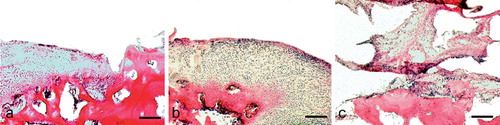 Figure 3. Histology of an osteochondral defect 12 weeks after insertion of the bioimplant modified with a cement separation layer. Hematoxylin-eosin staining. Bar represents 180 μm. A. Border of a defect. The defect zone on the right shows no covering with regenerated tissue, but exposed subchondral bone. The morphology of the cartilage at the border shows signs of degeneration such as clustering. B. At the center of the defect, under the level of joint cartilage there is hypercellular fibrous tissue almost without bony new formation. C. At the base of the defect, there is a sudden transition from fiber-rich tissue to cancellous bone. There is some hypercellular tissue in the bone marrow.