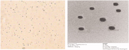 Figure 9. (a) Noisome image under motic digital microscope and (b) TEM image.
