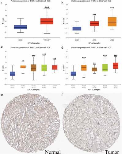 Figure 2. External verification of THBS3 protein expression in ccRCC; (A) Total THBS3 protein expression distributions in ccRCC primary tumor and normal tissues; (B) Total THBS3 protein expression distributions in different genders; (C) Total THBS3 protein expression distributions in different grades; (D) Total THBS3 protein expression distributions in different stages; (F-G) Immunohistochemical staining from the HPA database for THBS3; Scale bar = 200 um; *P <0.05; **P <0.01; ***P <0.001.