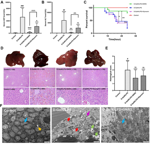 Figure 2 Protective effect of SNRS on LPS/D-GalN-induced ALF. Mouse serum was collected at 8 h after LPS/D-GalN injection, and the levels of ALF markers AST (A) and ALT (B) were assessed. (C) Effects of distinct treatments on the 24-hour survival rate of ALF mouse. (D) Hematoxylin and eosin (H & E) staining of mouse liver tissue in different treatment groups, the specimens were examined under microscope (×100 and ×400). (E) The severity of liver tissue sections was graded and scored from 0 to 4. (F) Microscopic changes of LPS/D-GalN attacked hepatocytes (blue arrow: normal mitochondrial structure, clearly visible internal ridge structure, intact mitochondrial membrane; red arrow: mitochondrial swelling and deformation, membrane continuity disruption, ridge disappearance; green arrow: intracellular cytoplasmic loss; purple arrow: discontinuous cell membrane structure; yellow arrow: autophagosome). #Model group compared with control group, #P<0.05, ##P<0.01, ###P<0.001. *Compared to model group, *P<0.05, **P<0.01, ***P<0.01. ΔSNRS group compared with silymarin group, ΔΔP<0.05, ΔΔΔP<0.05.