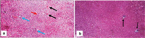 Figure 6. Histopathologic features of liver sections from sham-operated group. (a) Section stained with hematoxylin and eosin shows average central veins (black arrows), average portal tracts (blue arrows), and average hepatocytes (red arrow) (X200). (b) Masson trichrome stained section from the same group shows average collagen distribution around the central vein (black arrows) (X100).