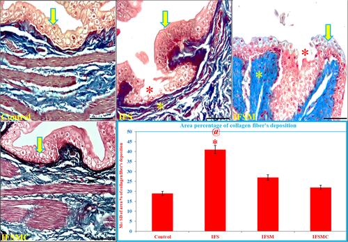Figure 5 Mesna and MCC effects on UB collagen fibers deposition of IFS-induced HC. The UB of the control and IFSMC groups exhibit normal transitional epithelium (yellow arrow) over the lamina propria. In contrast, the UB shows obvious large mucosal ulcer (red *) and collagen fibers deposition (yellow *) in the IFS group with moderate improvements of fibrosis in the IFSM group. Masson’s trichrome; 200x, bar = 100 µm. Statistical analysis of collagen fibers’ deposition in the UB of all groups. *P<0.05 vs the control and @P<0.05 vs the IFSMC group.