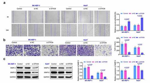 Figure 3. Knockdown of STK39 inhibited the invasiveness of HCC cells. (a) The migration of HCC cells was detected with the wound healing assays. (b) Transwell assays were used for the detection of the invasion of HCC cells. (c) The expression of MMP-2 and MMP-9 in HCC cells was detected with the western blotting. Each experiment repeated for three times. **p < 0.01 vs. si-NC