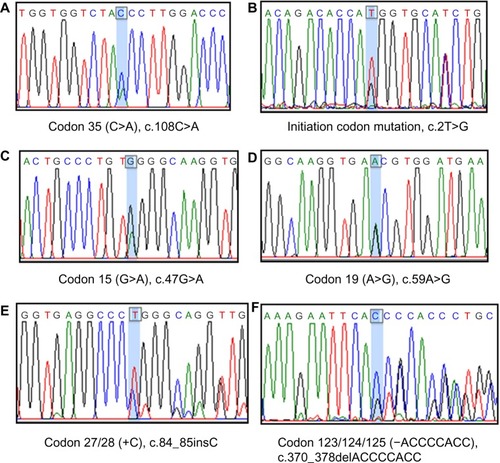 Figure 2 Six uncommon mutations identified by direct DNA sequencing.