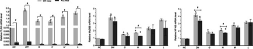 Figure 8 Effect of DMDD on the mRNA levels of TLR4, MyD88, and NF-κB. NC: normal control, DN: diabetic nephropathy group, G: gliquidone group (10 mg.kg−1.d−1), H: high dosage of DMDD group (50 mg.kg−1.d−1), M: medium dosage of DMDD group (25 mg.kg−1.d−1), L: low dosage of DMDD group (12.5 mg.kg−1.d−1). A and B: compared with the WT and KO normal controls (P<0.05); a and b: compared with the WT and KO diabetic nephropathy groups (P<0.05); and #: compared with WT mice (P<0.05).