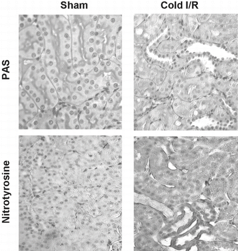 Figure 2 Representative micrographs of PAS (top) and nitrotyrosine (1:500)-stained (bottom) renal sections from rats exposed to cold I/R (40 min cold preservation  +  18 hr reperfusion). Experiments were repeated three times with similar results (400 × magnification).