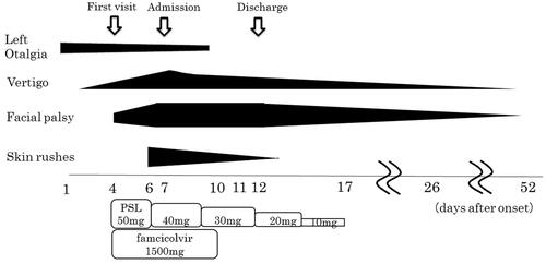 Figure 3. Course of symptoms and drug administration. PSL: prednisolone.