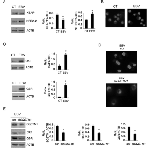 Figure 8. SQSTM1 accumulation activates the SQSTM1-KEAP1-NFE2L2 axis that reduces ROS production in EBV-infected monocytes. Differentiating monocytes exposed or unexposed to EBV and cultured for 5 days with CSF2 and IL4 were analyzed for (a) KEAP1 and NFE2L2 expression by western blot, (b) NFE2L2 localization by IFA and (c) CAT and GSR expression by western blot. ACTB was used as loading control. One representative experiment out of 3 is shown. The histograms represent the mean plus S.D. of the densitometric analysis of the ratio of KEAP1:ACTB, NFE2L2:ACTB, CAT:ACTB, GSR:ACTB of 3 different experiments. SQSTM1 staining is shown in red; bars: 10 mm. Differentiating monocytes exposed to EBV were silenced for siSQSTM1 with specific siRNA or scrambled siRNA and cultured for 5 days with CSF2 and IL4 before analysing (d) NFE2L2 localization by IFA and (e) SQSTM1, CAT and GSR expression by western blot. NFE2L2 staining is shown in red; bars: 10 mm. ACTB was used as loading control. One representative experiment out of 3 is shown. The histograms represent the mean plus S.D. of the densitometric analysis of the ratio of SQSTM1:ACTB, CAT:ACTB, GSR:ACTB of 3 different experiments. * P value < 0.05.