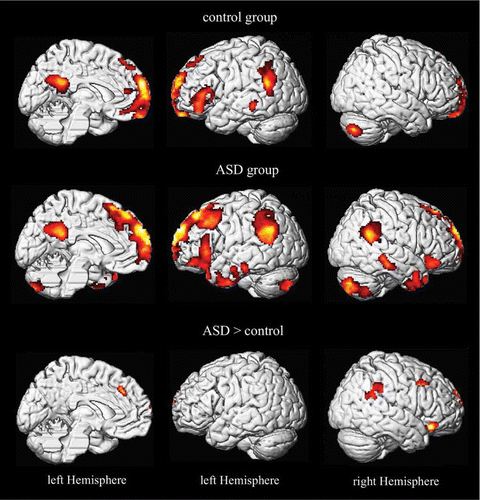 Figure 6. Brain activity during the self task (vs. high-level baseline) for ASD subjects and control subjects. SPMs are thresholded at p < 0.05, corrected for multiple comparison at the cluster level (p < .001 voxel level).