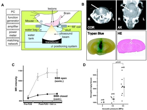 Figure 9 (A) Pattern diagram for the blood–brain barrier (BBB) opening in mice induced by MRI-guided focused ultrasound. (B) The mice BBB opening monitored by coronal (COR) and axial (AX) MR images (arrows). (Lower Left) Trypan blue staining the location of the BBB opening. (Lower Right) HE staining shows no apparent macroscopic damage related to BBB disruption. (C) MR-intensity change between the sonicated target (○) and the contralateral side (control; ●). (D) Graphs show Herceptin concentrations in the sonicated or control groups as a function of the applied acoustic pressure. *In the control (0 MPa), herceptin was below the lower limit of the detection range (780 ng/g of tissue) in eight of nine cases. Adapted from Kinoshita M, McDannold N, Jolesz FA, Hynynen K. Noninvasive localized delivery of Herceptin to the mouse brain by MRI-guided focused ultrasound-induced blood-brain barrier disruption. Proc Natl Acad Sci USA. 2006;103(31):11, 719–11, 723. © 2006 by The National Academy of Sciences of the USA.Citation137