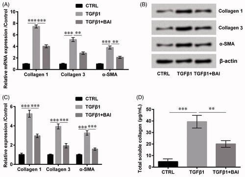 Figure 2. Baicalein alleviated collagen production. The expression of collagen 1, collagen 3 and α-SMA (A) in the mRNA level and (B, C) in protein level were determined by qRT-PCR and western blot, respectively. (D) The total soluble collagen was examined by Sircol Assay. Data is shown as mean ± SD. **p < .01; ***p < .001.