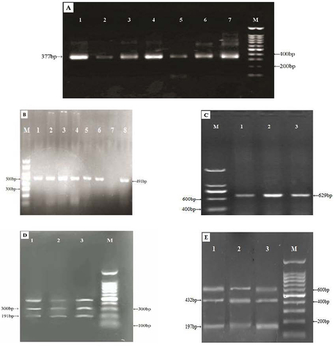 Figure 1 Images of agarose gel electrophoresis for each PCR amplification result. (A) The amplification result for T. pallidum -specific polA gene (377 bp) on agarose gel electrophoresis. M, 100-bp DNA ladder; lane 1, T. pallidum Nichols strain; lanes 2–7, T. pallidum samples from patients with latent syphilis from Xinjiang. (B) Agarose gel electrophoresis of nested PCR of 23S rRNA gene. M, 200-bp DNA ladder; lanes 1–6, uncut clinical isolate DNA (491 bp, A2058G) from patients with latent syphilis from Xinjiang; lane 7, negative control; lane 8, uncut strain SS14 DNA (491 bp, A2058G). (C) M, 200-bp DNA ladder; lanes 1–3, uncut clinical isolate DNA (629 bp, A2059G) from patients with latent syphilis from Xinjiang. (D) Agarose gel electrophoresis of restriction enzyme digestion products after nested PCR of the 23S rRNA gene. Lane 1, MboII digestion (191+300 bp) of strain SS14 DNA (A2058G); lanes 2 and 3, MboII digestion (191+300 bp) of clinical isolate DNA (A2058G) from patients with latent syphilis from Xinjiang; M, 100-bp DNA ladder. (E) Agarose gel electrophoresis of restriction enzyme digestion products after nested PCR of 23S rRNA gene. Lanes 1–3, BsaI digestion (197+432 bp) of clinical isolate DNA (A2059G) from patients with latent syphilis from Xinjiang; M, 100-bp DNA ladder.