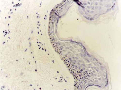 Figure 6.  H&E staining of human skin.