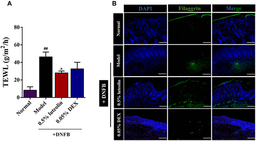 Figure 8 Luteolin recovers the impaired skin barrier. (A) Measurement of TEWL at day 12. (B) Immunofluorescence staining of FLG in skin lesions (magnification 100×). Values are expressed as mean ± SD (n =3~5). ## Indicates p < 0.01 as compared to Normal group; *Indicates p < 0.05 as compared to Model group.