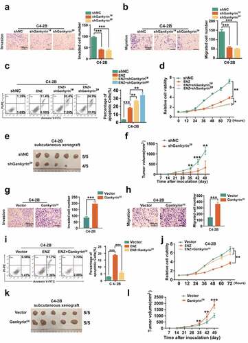 Figure 2. Gankyrin promotes the malignant features of prostate cancer. (a-b), Invasion (a) and migration (b) analyses were taken in C4-2B cells with or without gankyrin knockdown (scale bar = 100 μm). Quantification of invaded or migrated cells in the two groups is shown (right). (c-d)(, Apoptosis (c) and cell viability (d) analyses were performed in naïve C4-2B cells and enzalutamide-treated cells without or with gankyrin knockdown. (e-f), C4-2B cells with gankyrin knockdown and control cells were subcutaneously injected into nude mice (n = 5/group). Visual examination of isolated tumors from the two groups (e) and statistical analysis of tumor volume in the indicated groups after inoculation (f) are presented. (g-h), Invasion (g) and migration (h) analyses were taken in C4-2B cells with or without gankyrin overexpression (scale bar = 100 μm). Quantification of invaded or migrated cells in the two groups is shown (right). (i-j), Apoptosis (i) and cell viability (j) analyses were performed in naïve C4-2B cells and enzalutamide-treated C4-2B cells without or with gankyrin overexpression. (k-l), Gankyrin-overexpressing C4-2B cells and control cells were subcutaneously injected into nude mice (n = 5/group). Visual examination of isolated tumors from the two groups (k) and statistical analysis of tumor volume in the indicated groups after inoculation (l) are presented (*p < .05, **p < .01, and ***p < .001).