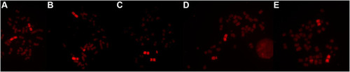 Figure 1 A representative example of a metaphase spread with normal chromosome 1 (A), translocation (B), acentric fragment (C), deletion (D), and insertion (E) detected by fluorescence in situ hybridization (FISH) using whole chromosome paints.