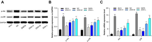 Figure 11 ZSW treatment regulates the expression of key nodes in PI3K-Akt and p38 MAPK signaling pathways activated in db/db mice. (A) Representative band of p-Akt and p-p38 protein detected by WB. (B) The relative protein levels of the WB results; (C) The levels of Akt and p38 MAPK mRNA assessed by RT-qPCR. Data are presented as mean ± SD (n = 3). **P < 0.01, vs db/m group; ##P < 0.01, vs NC group.