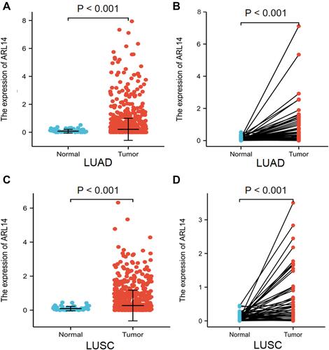 Figure 1 ARL14 expression in LUAD and LUSC. (A) ARL14 expression in LUAD tissues and normal samples. (B) ARL14 expression in LUAD tissues and paired normal samples. (C) ARL14 expression in LUSC tissues and normal samples. (D) ARL14 expression in LUSC tissues and paired normal samples.