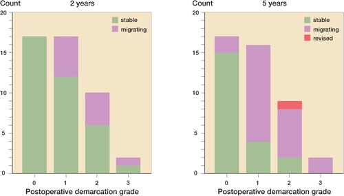 Figure 6. Distribution of migrating or stable cups determined by RSA at 2 and 5 years, respectively. Depending on the distribution of direct postoperative radiographical demarcation, all patients were grouped as grade 0 (no demarcation), grade 1 (outer 1/3), grade 2 (outer and middle 1/3) or grade 3 (complete demarcation).