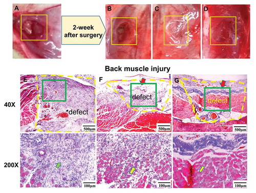 Figure 3. (a) Gross view of the back muscle defect setting up in the rat; (b) gross view and (e) Masson’s trichrome staining of the back muscle defect after 2 weeks without any dressing material covering (back muscle wound group); (c) gross view and (f) Masson’s trichrome staining of the back muscle defect after 2-week repairing with DAM dressing (DAM group); (d) gross view and (g) Masson’s trichrome staining of the back muscle defect after 2-week repairing with DAM-POC dressing (DAM-POC group). Back muscle defects were indicated with yellow rectangles in A–D and yellow dotted lines in E–G. Lower magnification (top) and higher magnification (bottom) of area in green rectangle were indicated in E–G. DAM and DAM-POC were indicated by red arrows in F and G. In E–G, inflammatory cell was indicated by the green arrow and the newborn myoﬁber was indicated by the yellow arrow