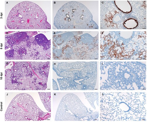 Figure 5. SARS-CoV-2 viral antigen in the lungs over the course of infection. Syrian hamsters were infected intranasally with 500 ID50 (103 TCID50) of SARS-CoV-2. Histopathology (HE) and immunohistochemistry (IHC) was used to assess pathology with the presence of SARS-CoV-2 antigen in pulmonary sections at 3, 5 and 10 dpi. (A-C), 3 dpi. (A) Histopathology is largely limited to bronchioles and terminal airway spaces and is not readily apparent at a low magnification (H&E, 20x, size bar is 200um). (B) Immunohistochemical reaction highlights antigen distribution in bronchioles and terminal airway spaces (20x, size bar is 200um). (C) Bronchiolar epithelial cell immunoreactivity with limited antigen detection in alveolar spaces (100x, size bar is 50um). (D-F), 5 dpi. (D) Extension of cellular exudate from bronchioles into alveolar spaces (H&E, 20x, size bar is 200um). (E) Immunoreactivity is detected along the periphery of regions of pathology and has largely been cleared from bronchiolar epithelium (20x, size bar is 200um). (F) Immunoreactivity is noted in type I and type II pneumocytes and few alveolar macrophages (200x, size bar is 20um). (G-I), 10 dpi (G) Resolving inflammation is limited to bronchioles and adjacent terminal airways (H&E, 20x, size bar is 200um). (H) SARS-CoV-2 immunoreactivity is not observed in regions of resolving inflammation (20x, size bar is 200um). (I) No immunoreactivity is observed (200x, size bar is 20um). (J-L), naïve animals. (J) Normal interstitial spaces (100x, size bar is 50um). (K) Normal bronchiolar epithelium (400x, size bar is 20um). (L) Normal tracheal mucosa (400x, size bar is 20um).