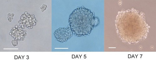 Figure 2 Sphere formation. Representative phase-contrast micrographs of spheres formed by Cal-27 cell lines. Bar: 100 μm.