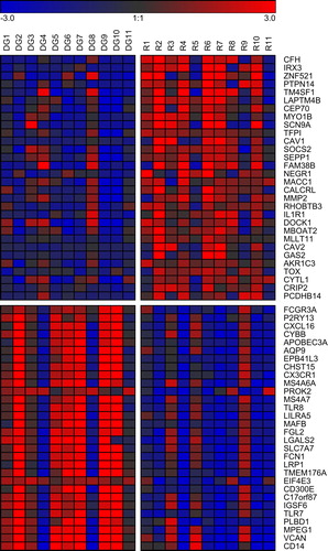 Figure 1. Genes differentially expressed between diagnosis and relapse of CN AML. Log2 fold changes compared to the mean of all samples are displayed for the 30 most up- and the 30 most down-regulated genes (i.e. significantly differentially expressed genes with the highest positive and negative mean log2 fold changes between the two disease states). Red, gene expression above the mean; blue, gene expression below the mean. DG, diagnosis; R, relapse.