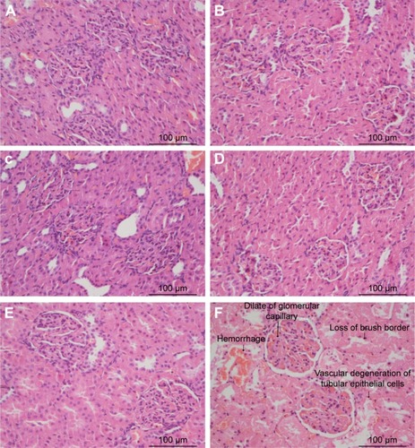 Figure 6 Kidney histopathology in septic rats of the three groups.