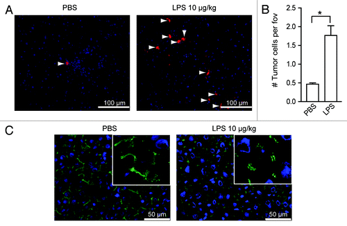 Figure 1. LPS stimulates tumor-cell adhesion in the liver by disrupting endothelial integrity. (A) Tumor cells in the livers of rats that had been treated with PBS or LPS and were sacrificed 1.5 h after tumor-cell inoculation. Red: DiI-labeled CC531s, blue: cell nuclei, arrowheads point to CC531s cells. (B) Quantification of tumor cells in the livers of rats after PBS or LPS treatment. n = 4 per group; *p < 0.05. (C) ZO-1 staining in the livers of rats that had been treated with PBS or LPS and were sacrificed after 1.5 h. Green: ZO-1; blue: nuclei.