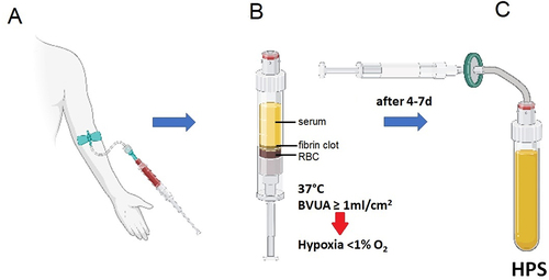 Figure 1. Preparation of hypoxia preconditioned serum (HPS) using the method of hypoxia-adjusted in vitro preconditioning. Peripheral venous blood is allowed to coagulate within the blood-sampling syringe, once this is placed upright in the temperature-control incubator. Sedimentation passively separates serum at the top, from the fibrin clot in the middle layer and red blood cells (RBC) at the bottom. Peripheral blood cells (within the clot layer) are conditioned under physiological temperature (37oC) and local-pericellular (i.e. surrounding the cellular-clot layer) hypoxia (~1%O2, this is automatically generated within the ‘bioreactor’ syringe as a result of cellular O2 consumption) for a defined period of time, typically 4–7 days, leading to production/secretion of cell-derived protein factors into the serum. Growth factor-rich HPS is extracted at the end of the incubation period through sterile filtration to remove cellular debris. BVUA refers to the blood volume per unit cross-sectional area of the blood-containing syringe.