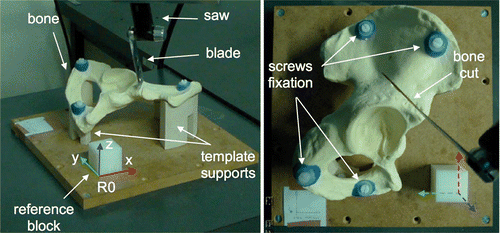Figure 1. Bone cutting performed with an oscillating saw. The simulated bone is a polyurethane foam right hemipelvic model and is clamped by means of template supports and screw fixation. The reference block is a plastic POM-C resin block and is used to define the global reference frame R0.