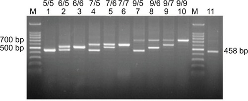 Figure 2 PCR-based genotyping of the DC-SIGNR neck region.Notes: Lanes 1–11 show samples from different individuals (patients or controls), and the genotype is labeled above, following the convention in Figure 1.Abbreviations: DC-SIGNR, dendritic cell-specific intercellular adhesion molecule-3 grabbing nonintegrin-related; M, 100 bp DNA markers.