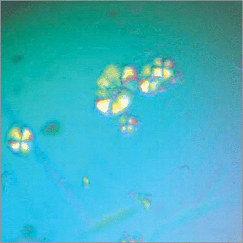 Figure 2 Crystals of the wild-type Ure2 octapeptide RQVNINIGNRNR viewed under the polarized microscope. The crystals were formed by incubating the octapeptide solution (10 mg/ml in Tris buffer pH 8.4 with 200 mM NaCl) at 4°C overnight.