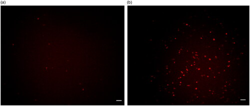 Figure 8. Fluorescence image of HepG-2 treated with (a) free ICG and (b) Ag-Au-ICG in 1% Intralipid for 1 h. Scale bar, 50 µm.