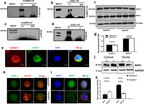 Figure 3. GGNBP2 interacts and colocalizes with ASXL1. The absence of GGNBP2 affects ASXL1 and BAP1 interaction as well as BAP1 translocation.