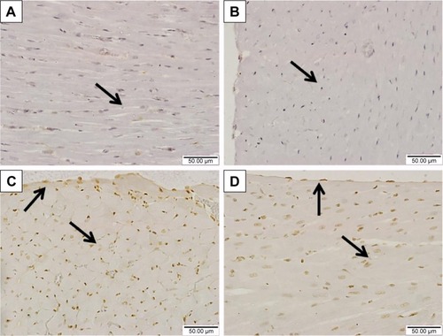 Figure 8 Effect of sitagliptin on STAT3 phosphorylation in the heart of control and diabetic rats.