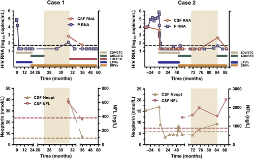 Figure 1. Two cases of CSF escape during darunavir/r monotherapy (period shaded). Upper panels show cerebrospinal fluid (CSF) and plasma (P) HIV RNA together with treatment history; time 0 represents first initiation of antiretroviral treatment; dotted lines correspond to 50 copies/ml. Lower panels show CSF neopterin and neurofilament light protein (NFL) concentrations; dotted lines represent upper normal limits.