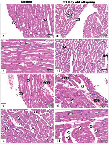 Figure 9. Images from histological sections of heart ventricles of control (a&b) and IS mother rats (c&d) (left hand panels) and their offspring at PND21(control:a1&b1and IS:c1&d1)(right hand panels). In control group the pericardium (PC) endocardium (EC) and mocardium (MC) appear intact. In IS female rats and their pups the ventricular sections showing hypertrophied (arrow heads), necrotic myocardial cells (arrows), congested (CBC) and dilated blood capillaries (DBC), and less tight junction among myocardial fibers (star).