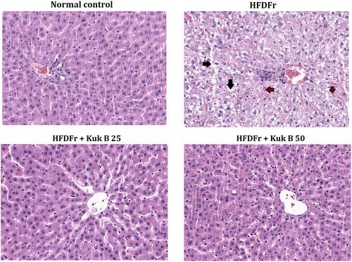 Figure 7 The effect of Kuk B on liver pathological lesions.Notes: Representative images of liver section stained with H&E. Lipid accumulation (black arrow). Inﬂammatory cells (brown arrow).Abbreviations: Kuk B, kukoamine B; H&E, haemotoxylin and eosin; HFDFr, high-fat diet/high fructose.